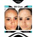 3 Seans BB Glow Kalıcı Fondöten